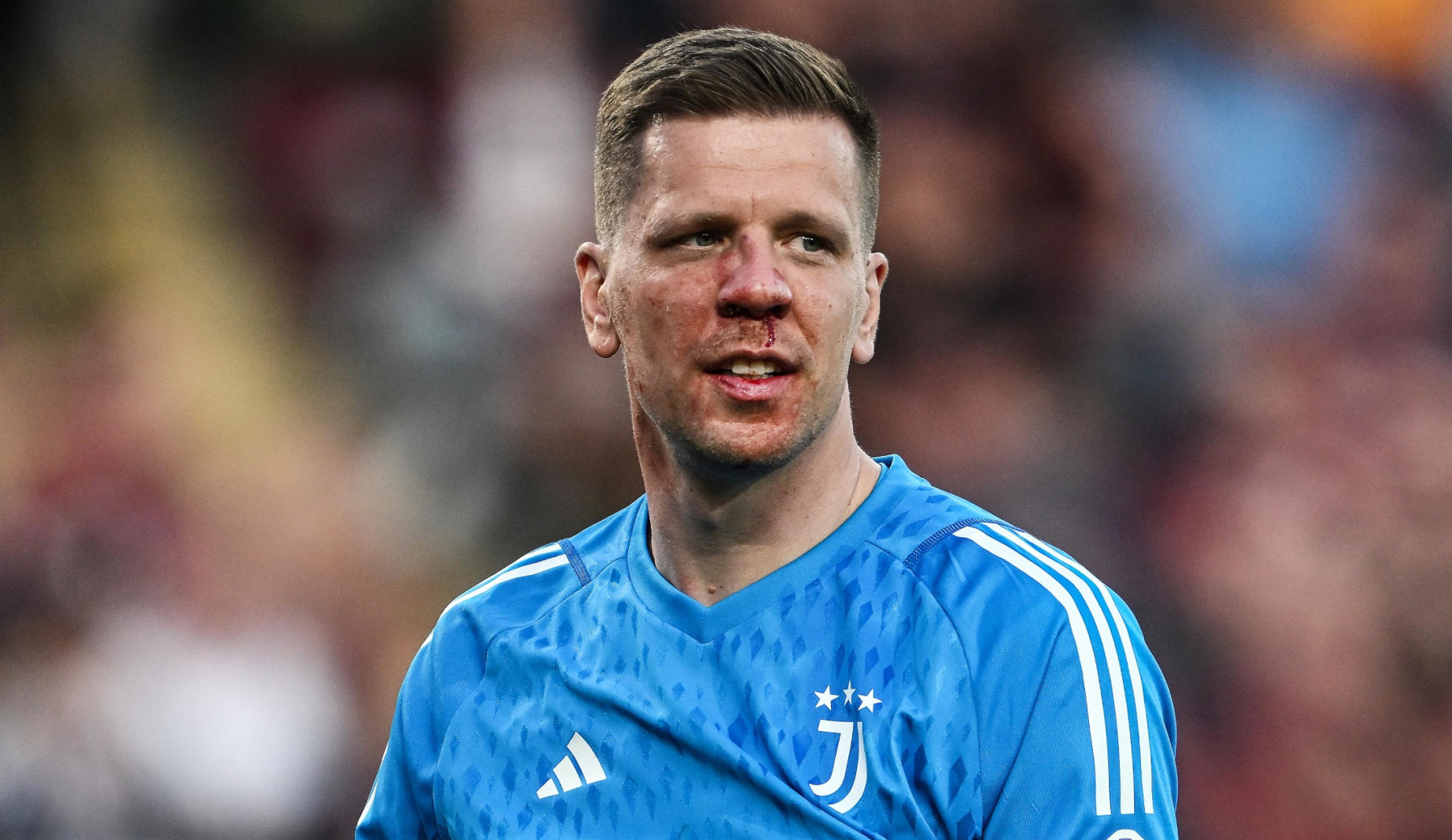 szczesny-infortunio-juventus-agency.jpg